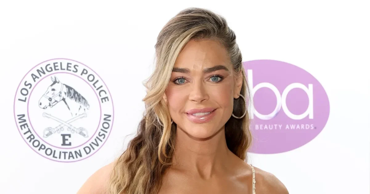 Дениз Ричардс откровенно рассказала о своей подтяжке лица