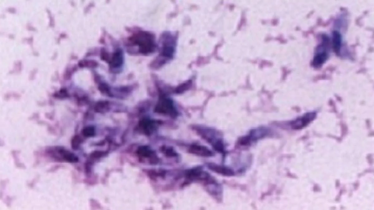 Новое исследование: связь болезни Альцгеймера с инфекциями требует проверки