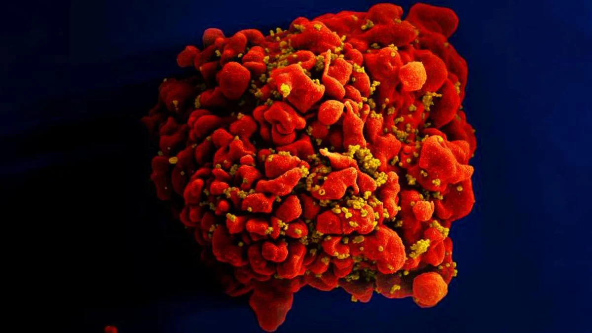 Число новых случаев ВИЧ в России достигло исторического минимума: данные Минздрава