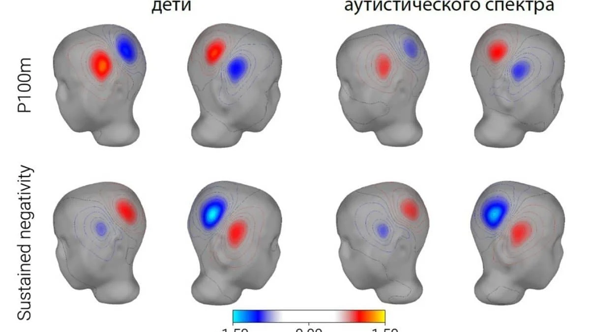 Нейронаука раскрывает связь между обработкой звуков и речевыми нарушениями при аутизме